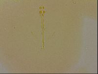 Ramazzottius oberhaeuseri image