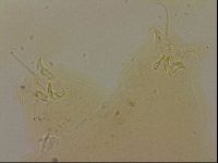 Ramazzottius oberhaeuseri image