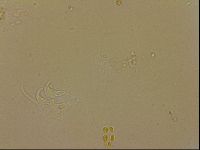 Ramazzottius oberhaeuseri image