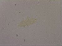 Ramazzottius oberhaeuseri image
