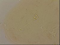 Ramazzottius oberhaeuseri image