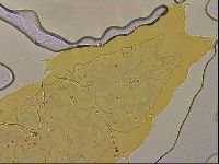 Ramazzottius oberhaeuseri image