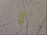 Ramazzottius oberhaeuseri image