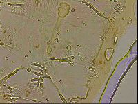 Ramazzottius oberhaeuseri image