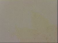 Ramazzottius oberhaeuseri image
