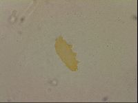 Ramazzottius oberhaeuseri image