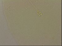 Ramazzottius oberhaeuseri image