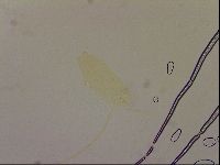 Ramazzottius oberhaeuseri image