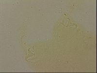 Ramazzottius oberhaeuseri image