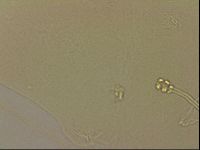 Ramazzottius oberhaeuseri image
