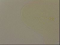 Ramazzottius oberhaeuseri image