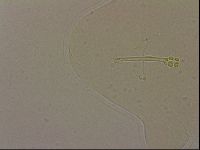 Ramazzottius oberhaeuseri image