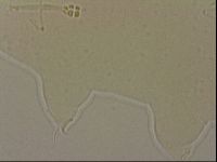 Ramazzottius oberhaeuseri image