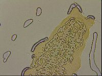 Ramazzottius oberhaeuseri image