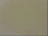 Ramazzottius oberhaeuseri image