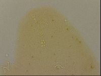 Ramazzottius oberhaeuseri image