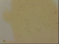Ramazzottius oberhaeuseri image
