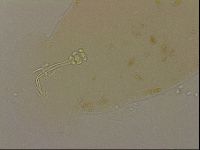 Ramazzottius oberhaeuseri image