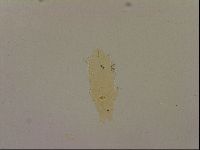 Ramazzottius oberhaeuseri image