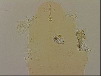 Ramazzottius oberhaeuseri image