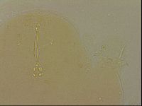 Ramazzottius oberhaeuseri image