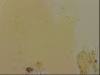 Ramazzottius oberhaeuseri image