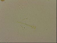 Ramazzottius oberhaeuseri image