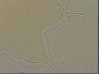 Ramazzottius oberhaeuseri image
