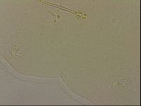 Ramazzottius oberhaeuseri image