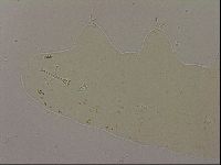 Ramazzottius oberhaeuseri image