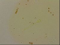 Ramazzottius oberhaeuseri image