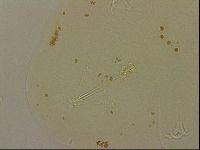 Ramazzottius oberhaeuseri image
