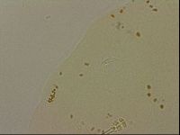 Ramazzottius oberhaeuseri image