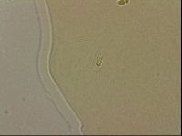 Ramazzottius oberhaeuseri image