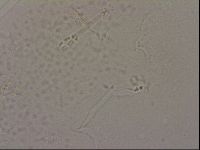 Hypsibius dujardini image