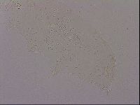 Hypsibius dujardini image