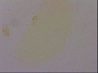 Hypsibius dujardini image