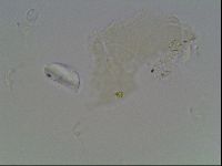 Hypsibius dujardini image