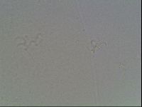 Hypsibius dujardini image