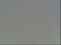 Hypsibius convergens image