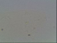 Hypsibius convergens image