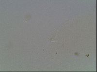 Hypsibius convergens image