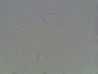 Hypsibius convergens image
