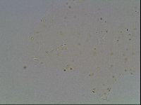 Hypsibius convergens image