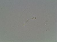 Hypsibius convergens image