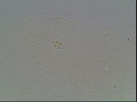 Hypsibius convergens image