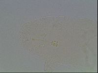 Hypsibius convergens image
