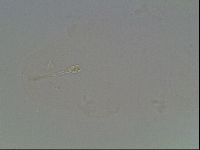 Hypsibius convergens image