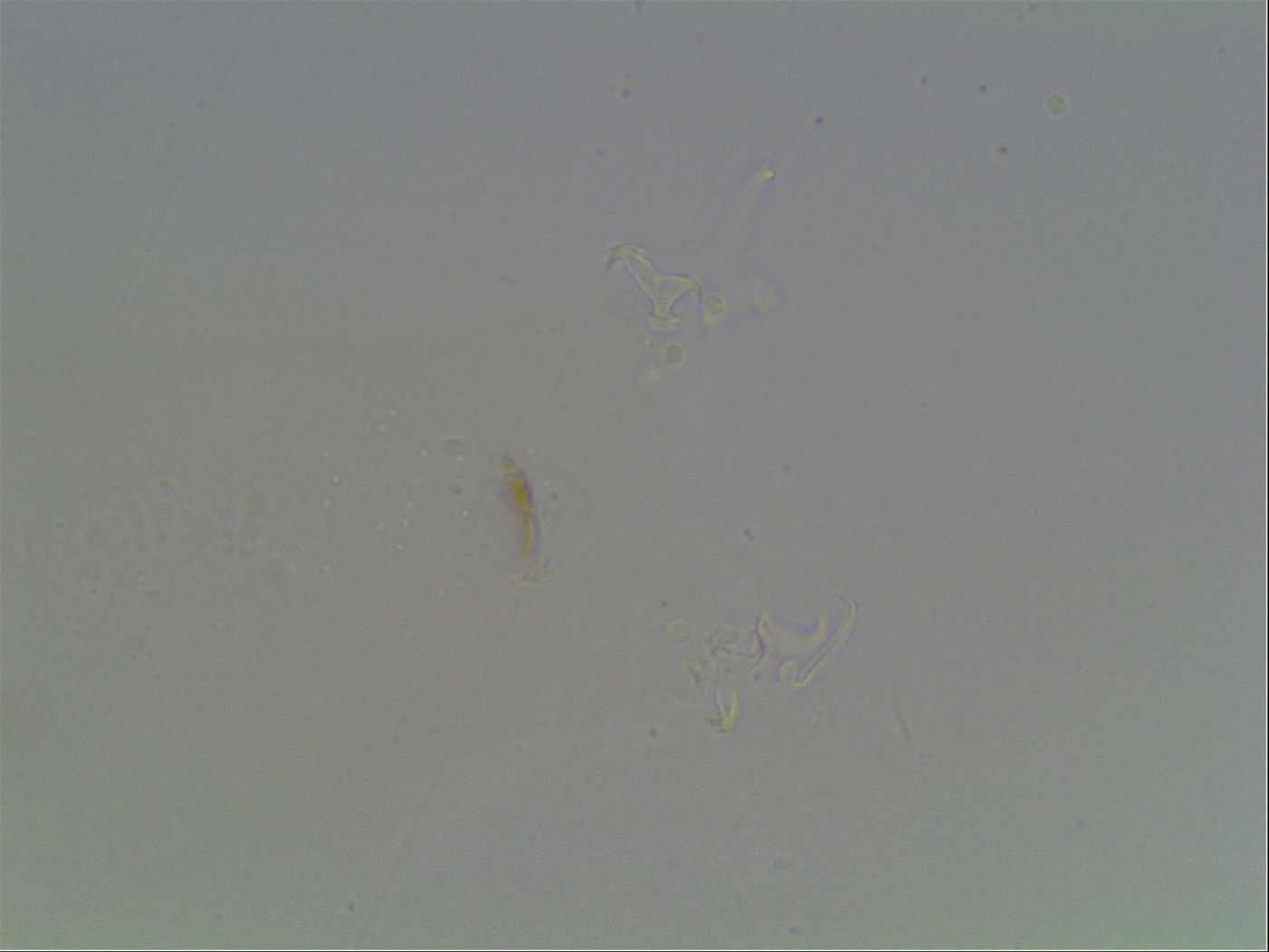 Hypsibius convergens image