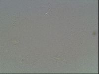 Hypsibius convergens image